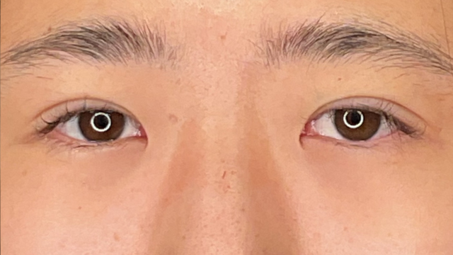 Postoperative Condition Part 1