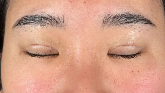 手术前的状态 其一