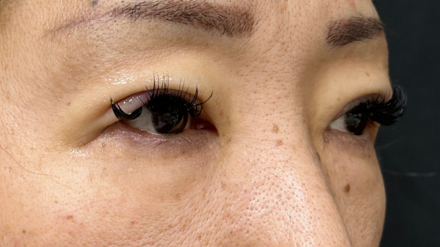 手术前的状态 其一