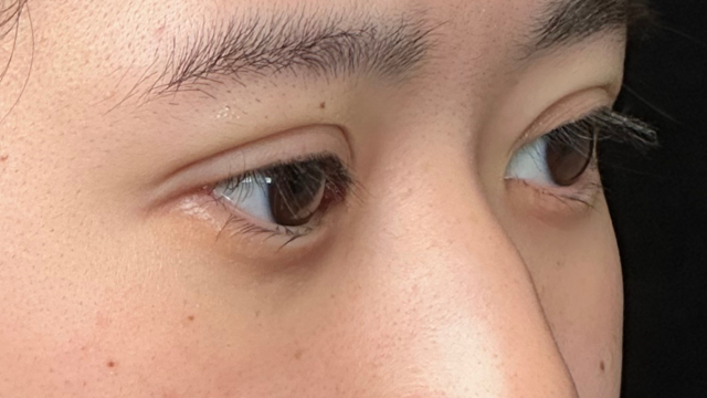 手术前的状态 其一