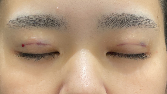 Postoperative Condition Part 1