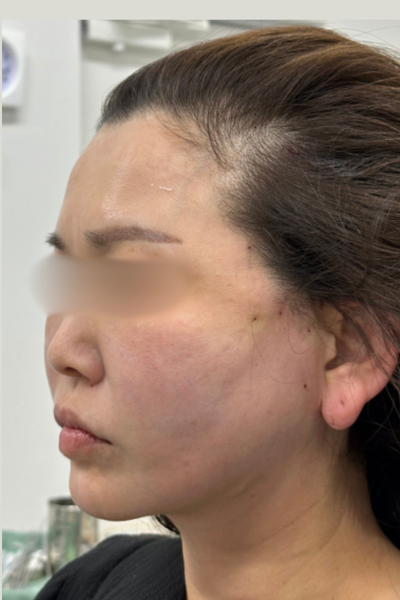 手術前の状態 その1