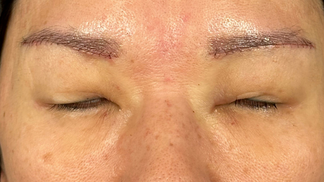 Postoperative Condition Part 1