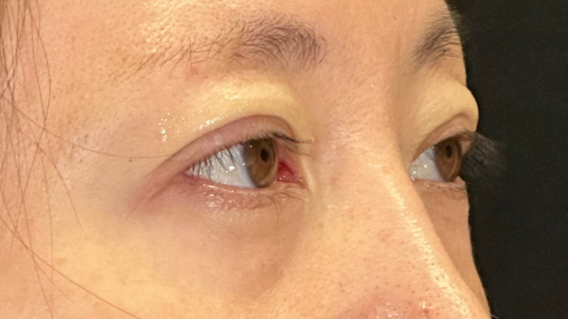 手術前の状態 その1