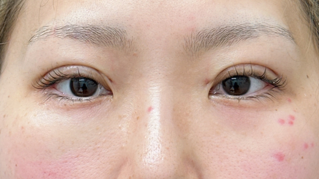 手术前的状态 其一