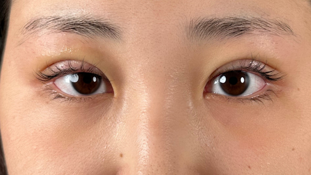 手术前的状态 其一