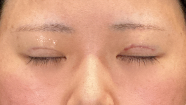 手術前の状態 その1