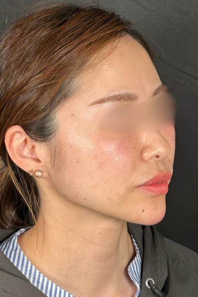 手术前的状态 其一