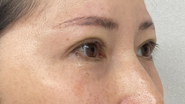 Postoperative Condition Part 1