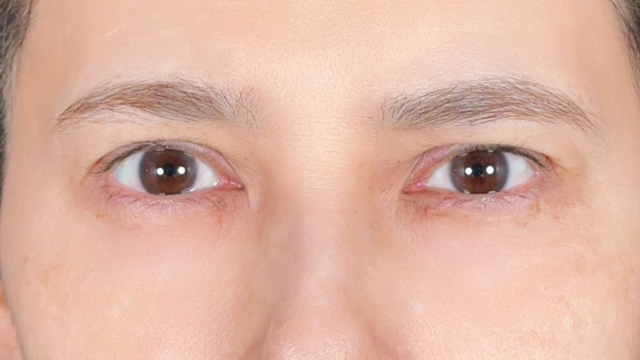 手术前的状态 其一