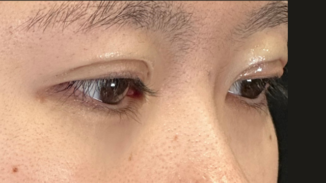 手术前的状态 其一