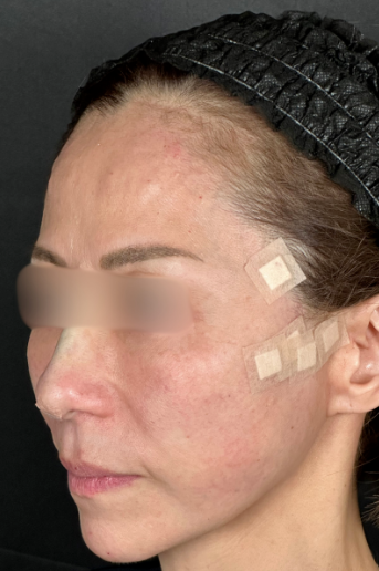 手術前の状態 その1