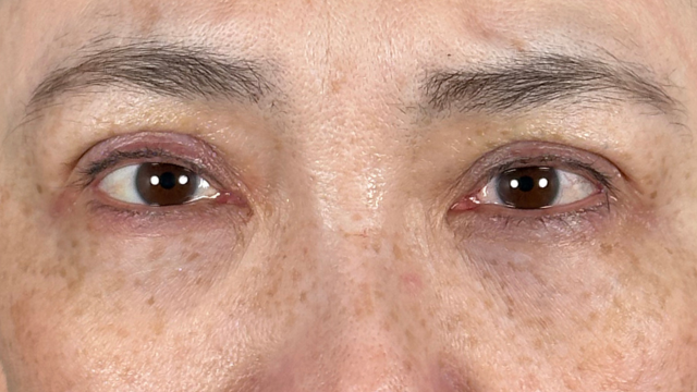 手术前的状态 其一