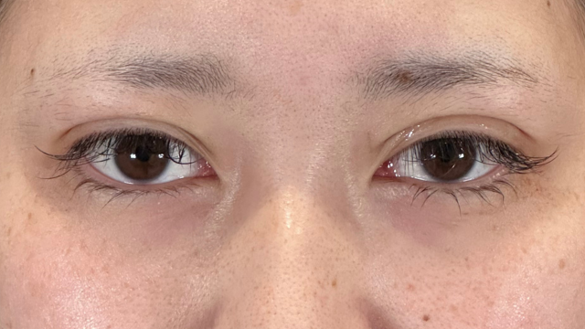 Postoperative Condition Part 1