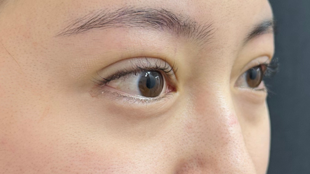 手术前的状态 其一