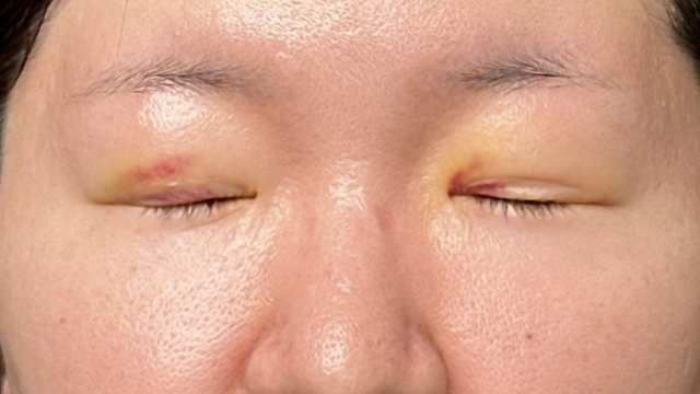 手术前的状态 其一