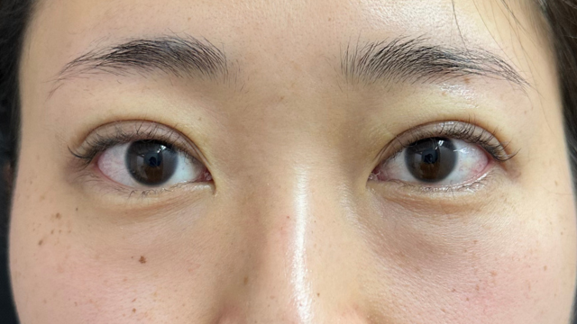 手术前的状态 其一