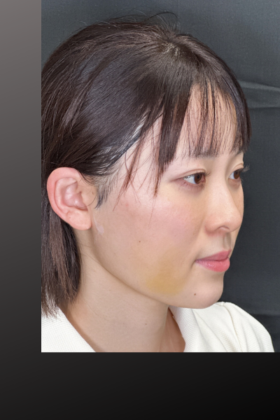 手術前の状態 その1