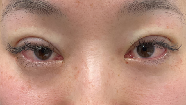 手术前的状态 其一