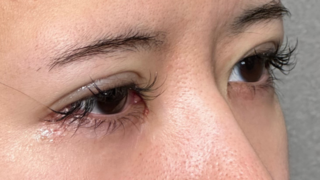 手术前的状态 其一