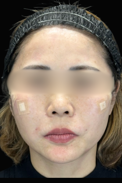 手術前の状態 その1