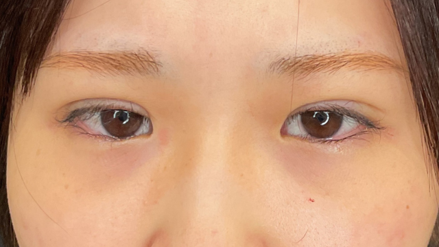 手术前的状态 其一