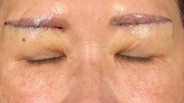 手術前の状態 その1