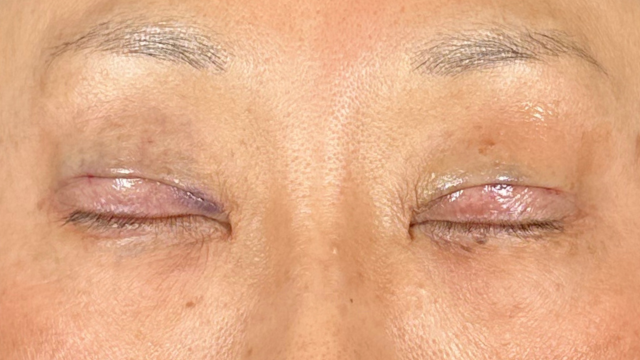 手術前の状態 その1