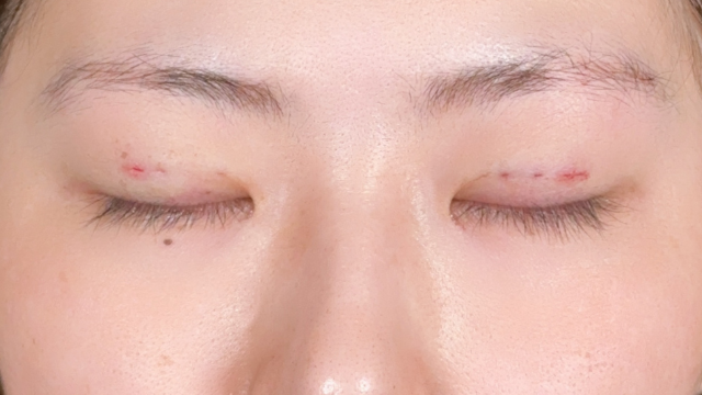 手术前的状态 其一