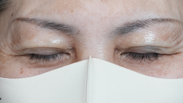 手术前的状态 其一