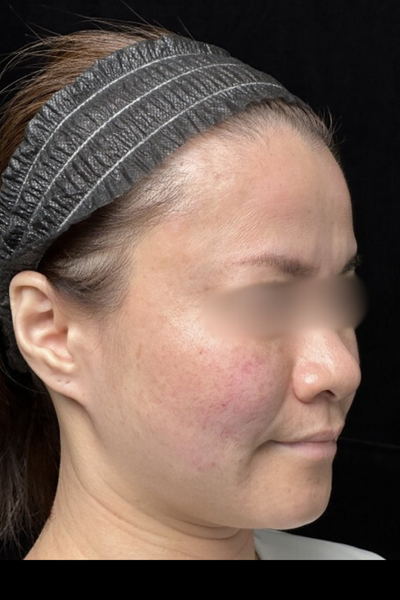 手術前の状態 その1