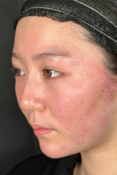 手術前の状態 その1