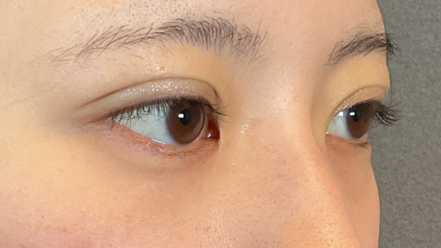 手术前的状态 其一