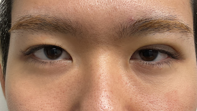 Postoperative Condition Part 1