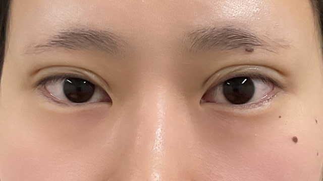 Postoperative Condition Part 1