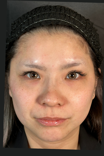 手术前的状态 其一