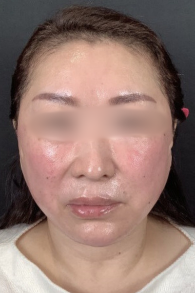 Postoperative Condition Part 1