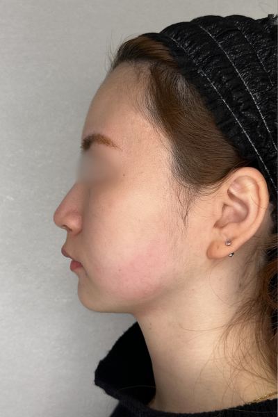 手術前の状態 その1