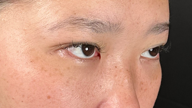 手术前的状态 其一