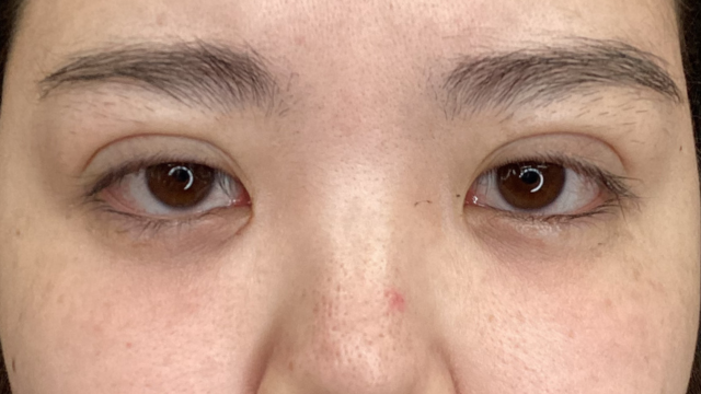 手术前的状态 其一