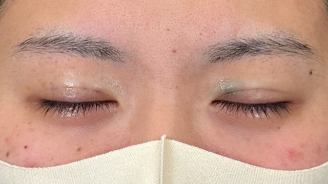 Postoperative Condition Part 1