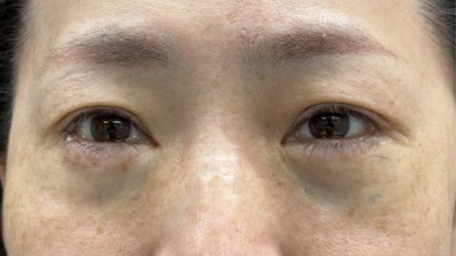 手术前的状态 其一