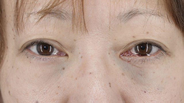 Postoperative Condition Part 1