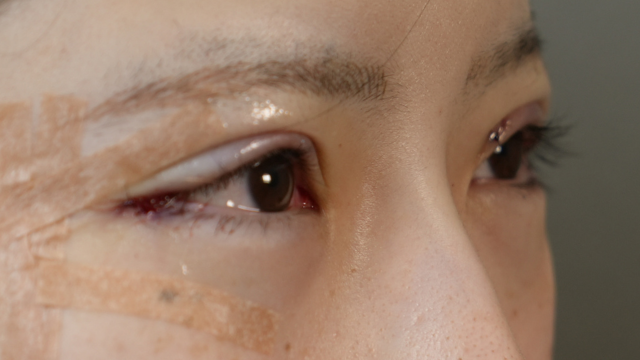 手術前の状態 その1