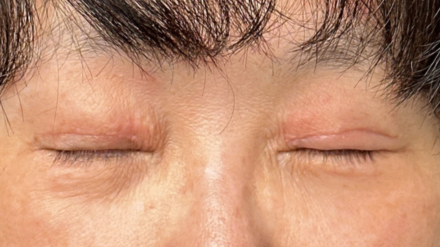 Postoperative Condition Part 1