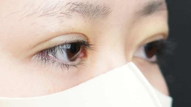 手术前的状态 其一