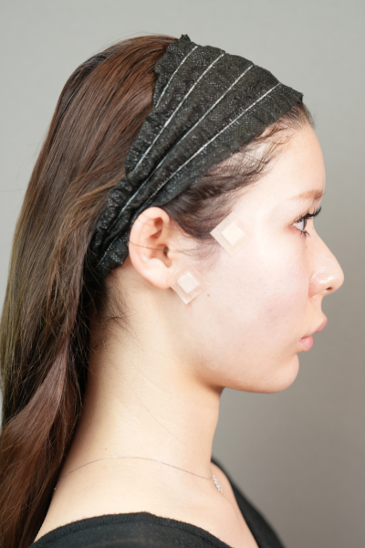 手術前の状態 その1