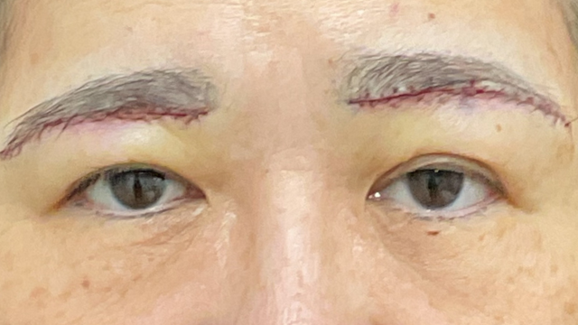 Postoperative Condition Part 1