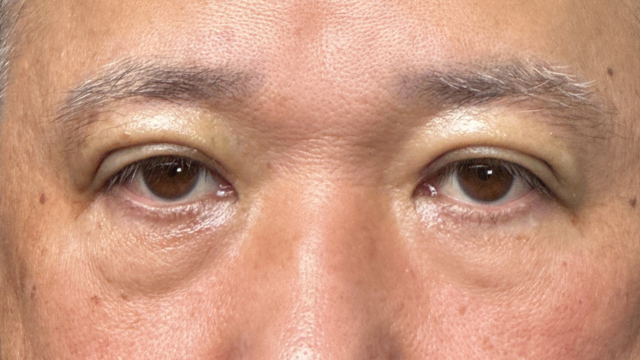 手术前的状态 其一