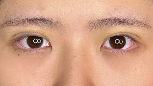 手术前的状态 其一